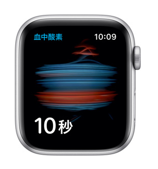 AppleWatch